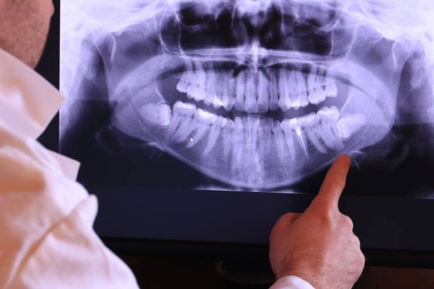 Best Dentist for Tooth Abscess  in Stony Prairie, OH